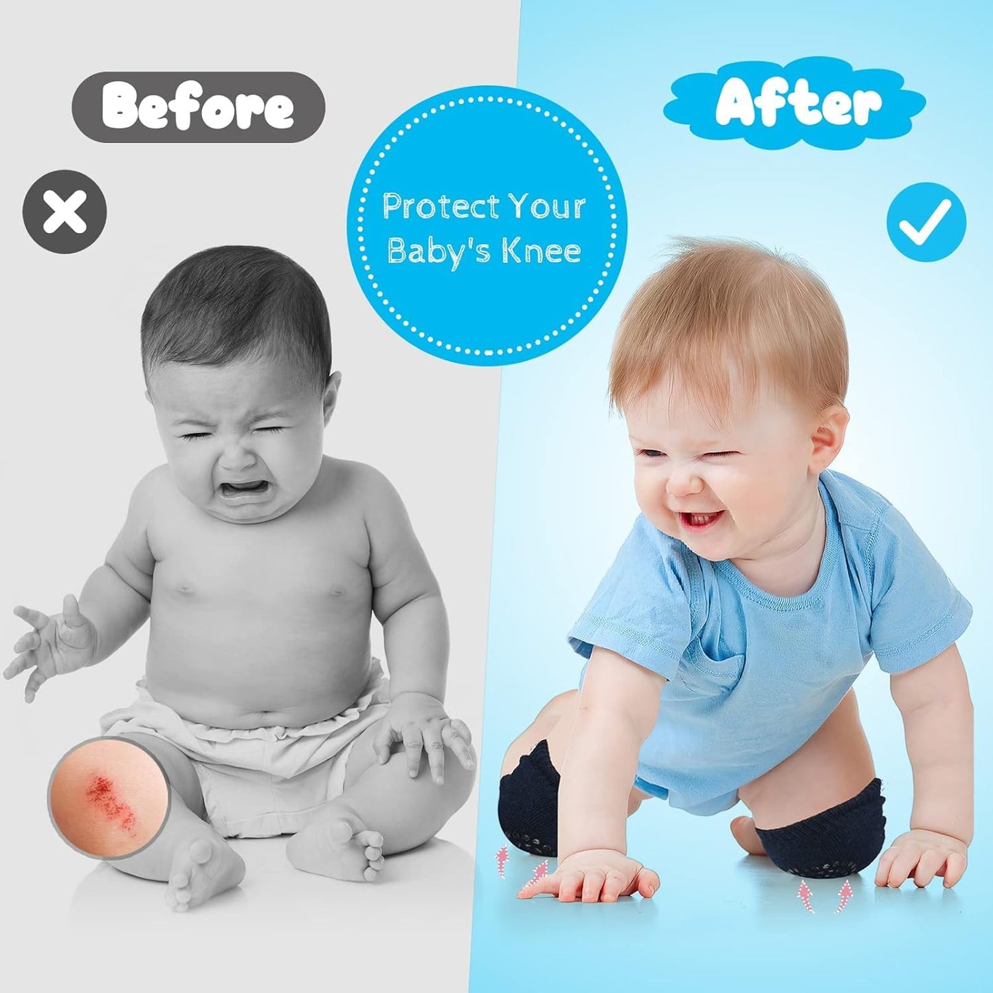 "Tiny Knees, Big Protection! – Soft Baby Knee Pads (2-Pair Set)"