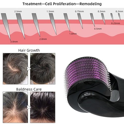 "The Secret to Fuller Hair & Glowing Skin – 0.5mm Derma Roller" 💆‍♂️💖